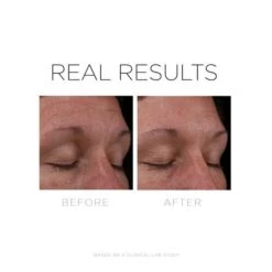 Cosmedix Serum 16 -Skin Care Products Store CosmedixSerum16beforeandafter