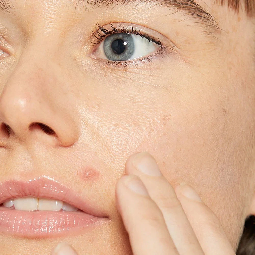 Dermalogica Deep Breakout Liquid Patch 7 Dermalogica Deep Breakout Liquid Patch - Image 5