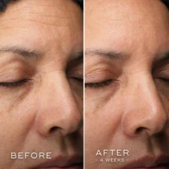 Medik8 C-Tetra Luxe -Skin Care Products Store Medik8C TetraLuxeBefore After