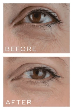 Medik8 Crystal Retinal 3 -Skin Care Products Store Medik8CrystalRetinal3beforeandafter