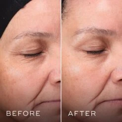 Medik8 Press & Glow -Skin Care Products Store Medik8Press GlowBefore After