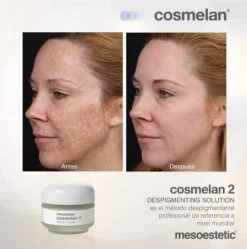 Mesoestetic Cosmelan 2 Maintenance Cream -Skin Care Products Store Mesoestetic Cosmelan 2 Maintenence Cream