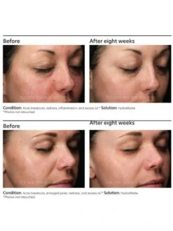 PCA Skin HydraMatte -Skin Care Products Store PCASkinHydraMatteOnline