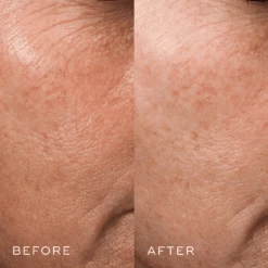 Medik8 Crystal Retinal 3 -Skin Care Products Store before after 2 medik8 howtoUseMedik8CrystalRetinal