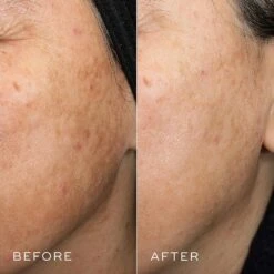 Medik8 Crystal Retinal 10 34 Medik8 Crystal Retinal 10 -Skin Care Products Store crystal 10 retinal