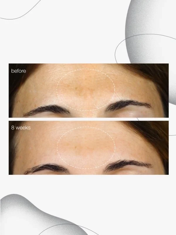 Dermalogica Powerbright Dark Spot Serum 5 Dermalogica Powerbright Dark Spot Serum - Image 3