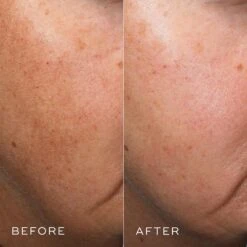 Medik8 Crystal Retinal 10 35 Medik8 Crystal Retinal 10 -Skin Care Products Store medik8 crystal 10 before after