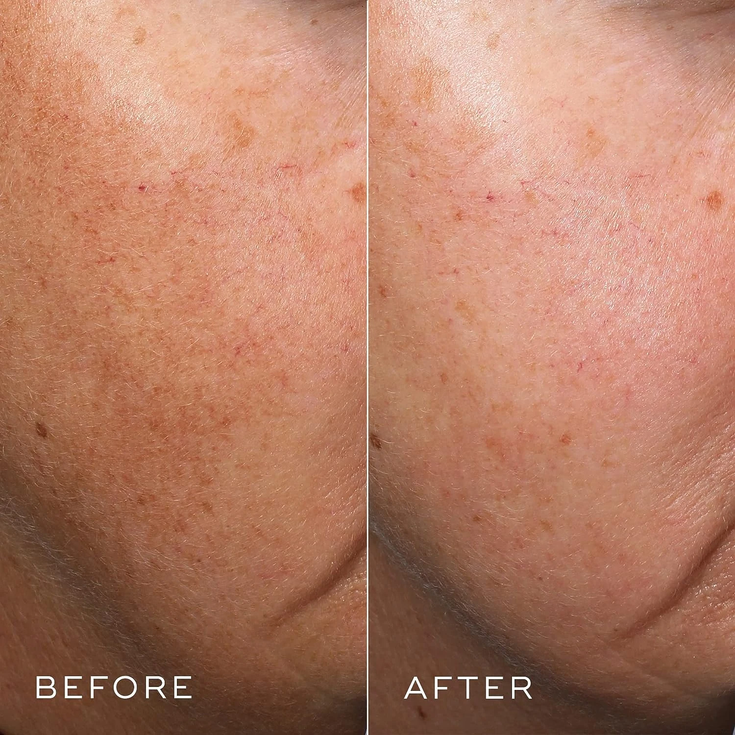 Medik8 Crystal Retinal 10 19 Medik8 Crystal Retinal 10 - Image 17